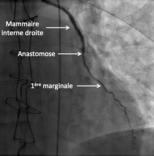 4èmes rencontres de la recherche clinique